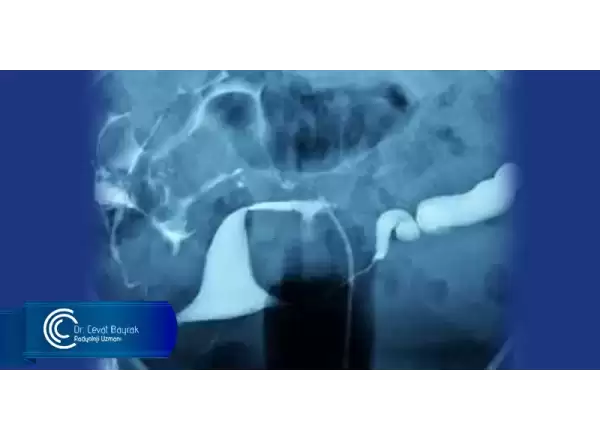 hsg-filmi-kimler-icin-uygundur