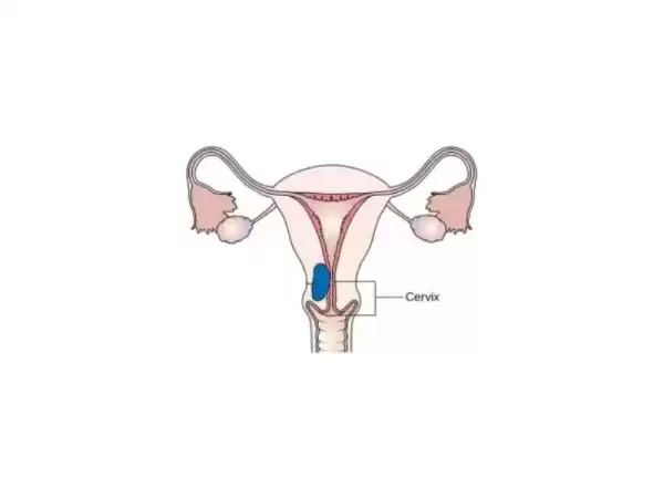 hsg-filmi-oncesi-yapilmasi-gerekenler