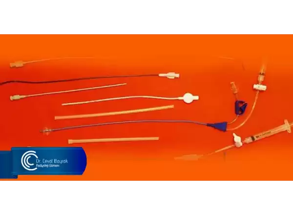 hsg-kateterleri-ve-kullanimi