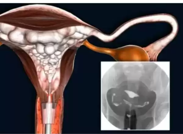 ilacli-rahim-filmi-hsg
