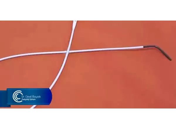 selektif-salpingografi