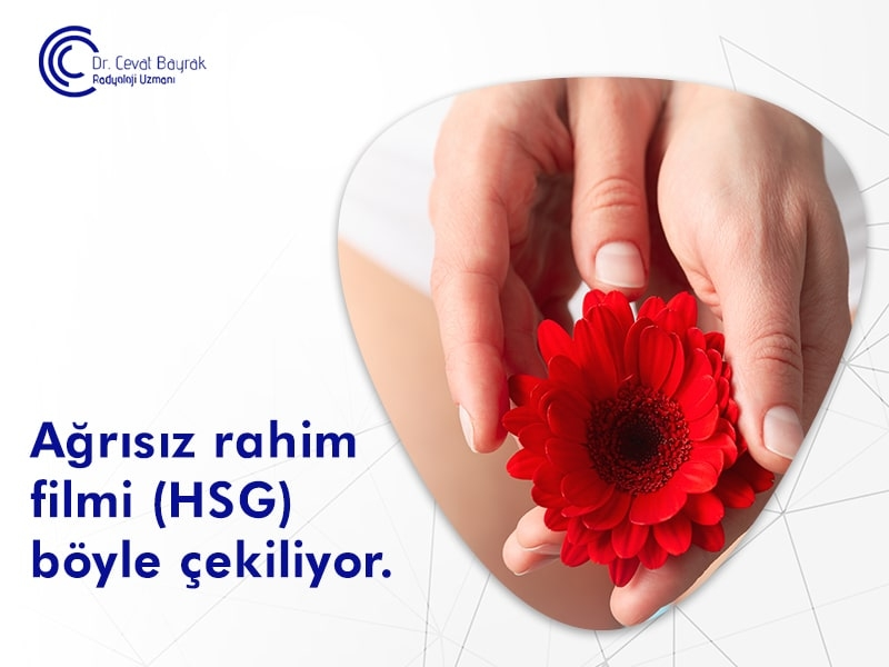 HSG,HSG testi,HSG filmi,rahim filmi çektirenler,rahim filmi nasıl çekilir,rahim filmi ağrılımı,rahim filmi ne kadar sürer,HSG çektirenler,HSG filmi çektirenler,rahim filmi