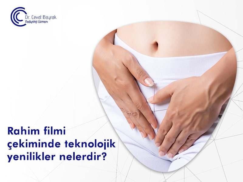 rahim filminde teknolojik yenilikler,dr cevat bayrak,rahim filmi,ağrısız rahim filmi,hsg,hsg testi,hsg filmi,şişli echomar,cevat bayrak,şişli echomar rahim filmi,rahim filmi ücreti,HSG çekimi,HSG filmi,HSG fiyatları,rahim filmi nerede çekilir,r