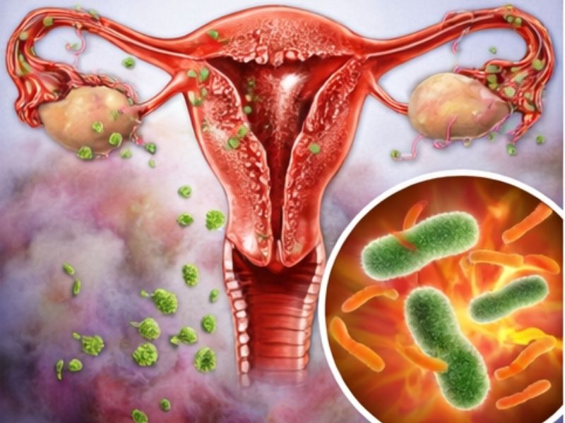 hsg-sonrasi-ne-zaman-doktora-basvurulmali